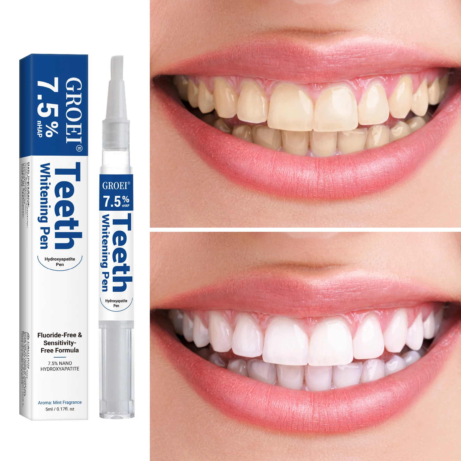 Caneta branqueadora de dente h - Teeth Whitening Essence avaliação e preço