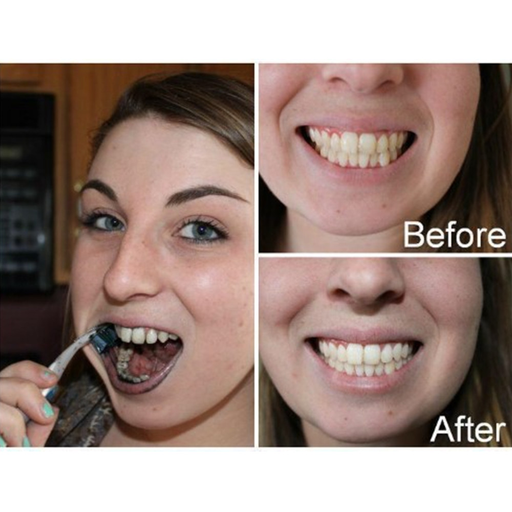 Dentes de carvão vegetal de ba - Teeth Whitening Diy avaliação e preço