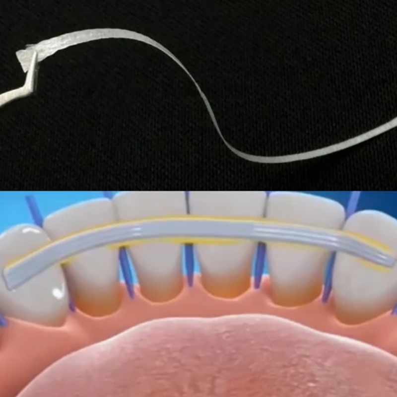 1/2/3/5 Peças Tiras de Fixação - Teeth Whitening Strips Lumineux avaliação e preço