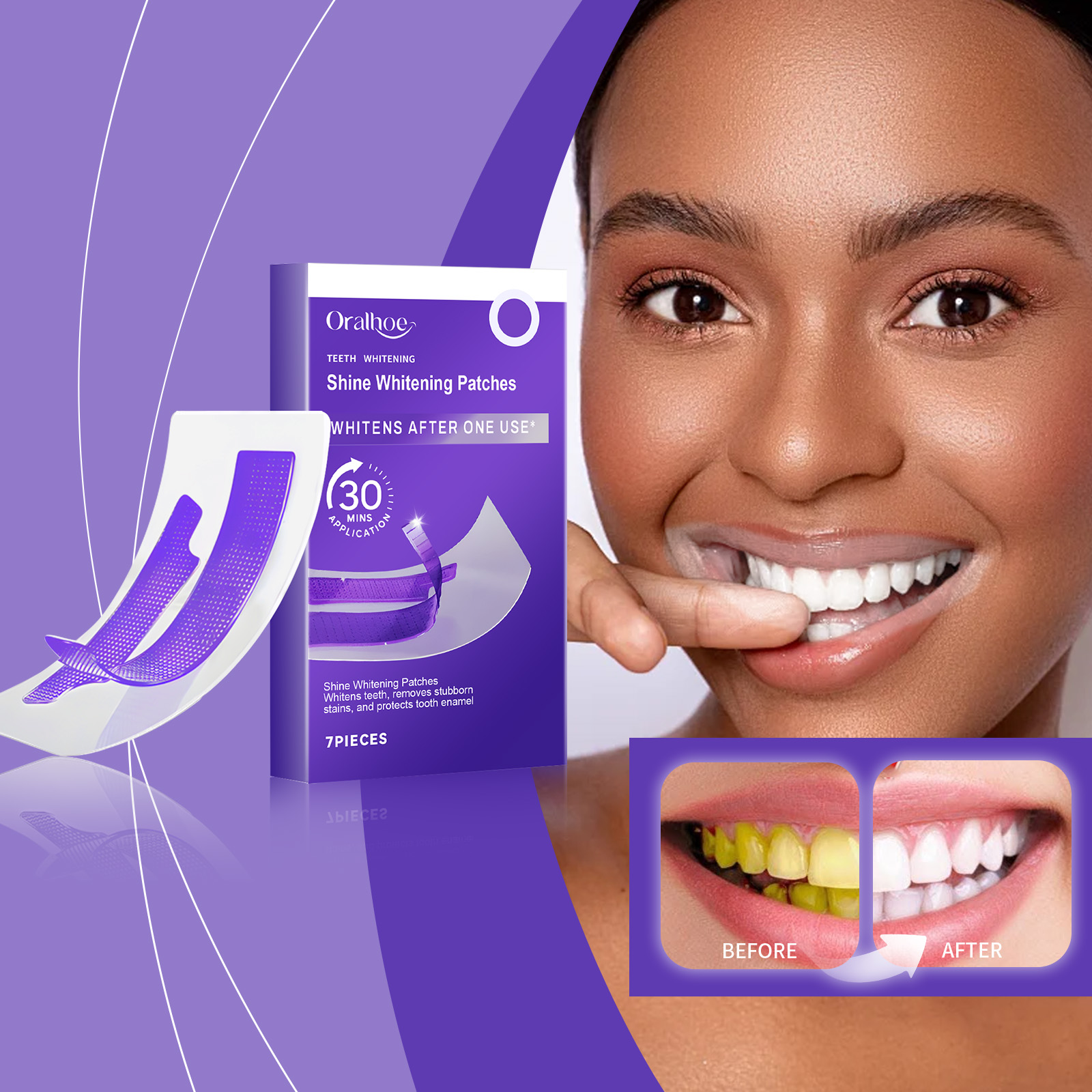 Tiras Clareadoras de Dentes Ro - Teeth Whitening/Bleaching avaliação e preço