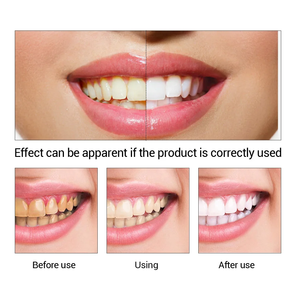 FTEENPLY Essência para claream - Teeth Whitening Essence avaliação e preço