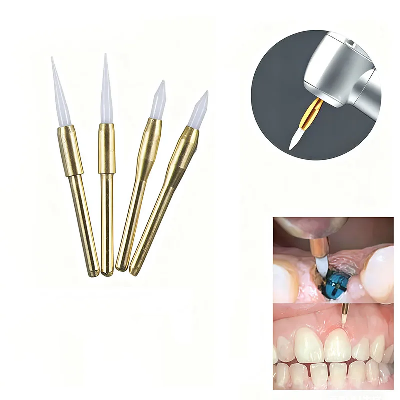 1 unidade de Brocas Odontológi - Teeth Whitening Uk avaliação e preço