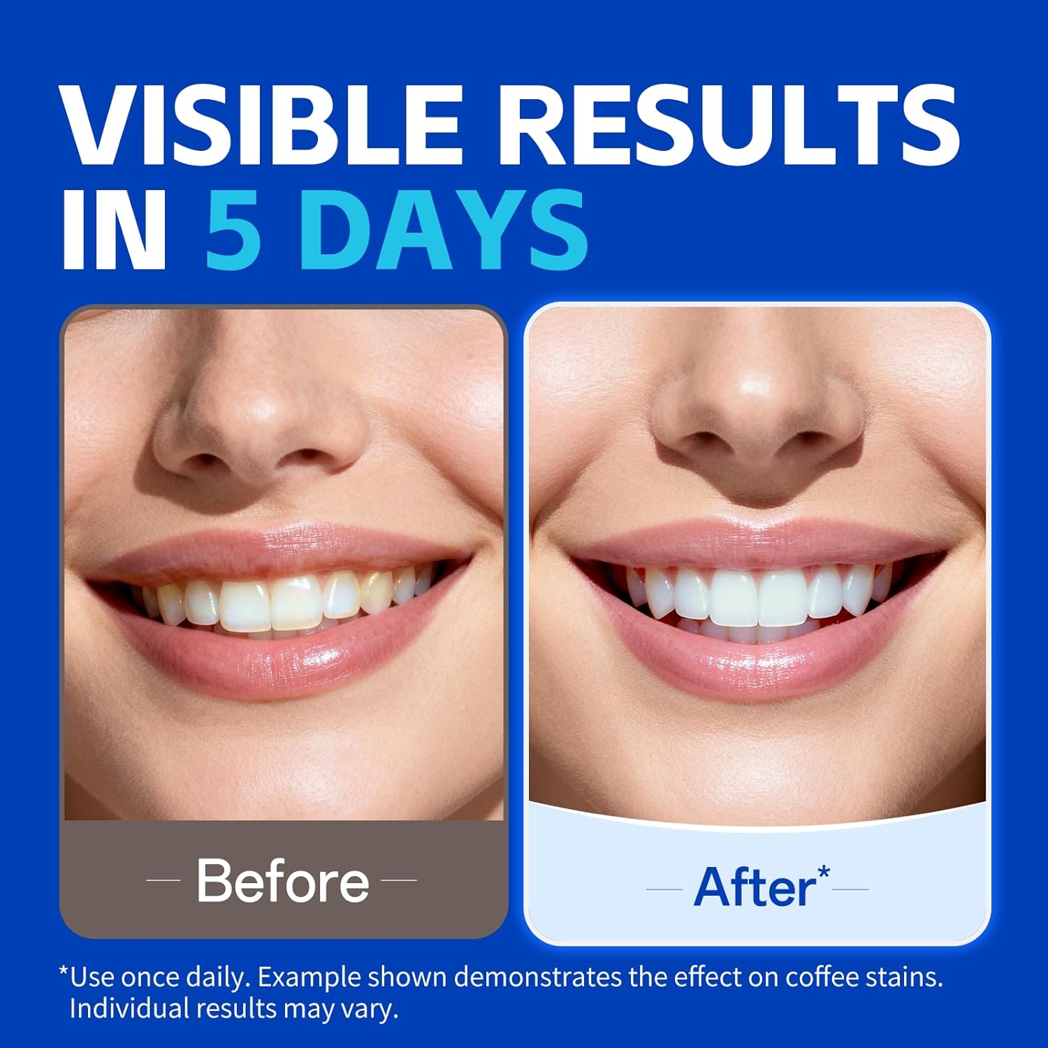 1/7 pares de tiras de clareame - Teeth Whitening Strips Permanent avaliação e preço