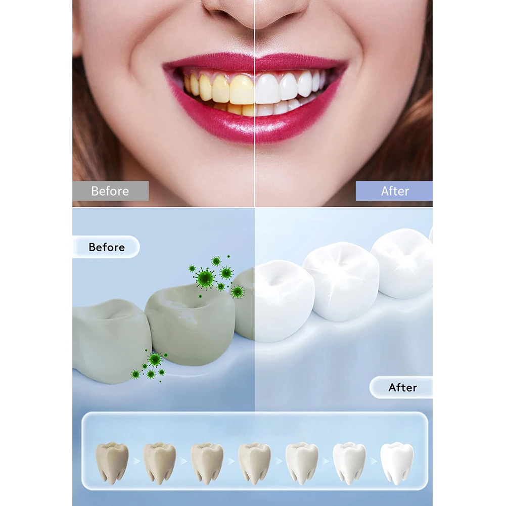 1pc casa inteligente led lâmpa - Teeth Whitening Uv avaliação e preço