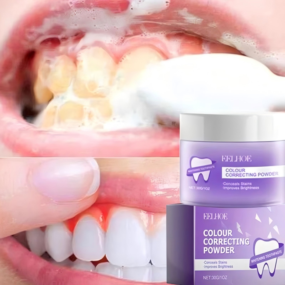 Roxo dentes branqueamento em p - Teeth Whitening/Bleaching avaliação e preço