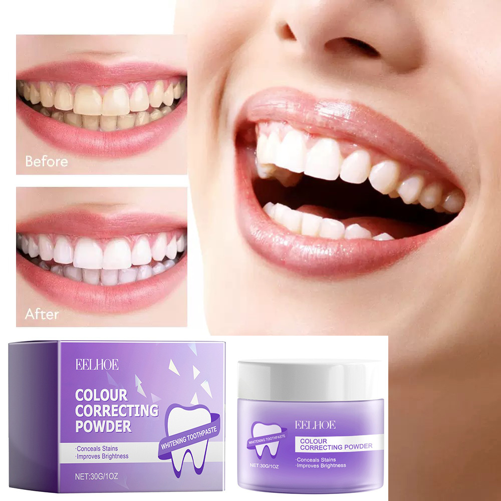 Roxo dentes branqueamento em p - Teeth Whitening/Bleaching avaliação e preço