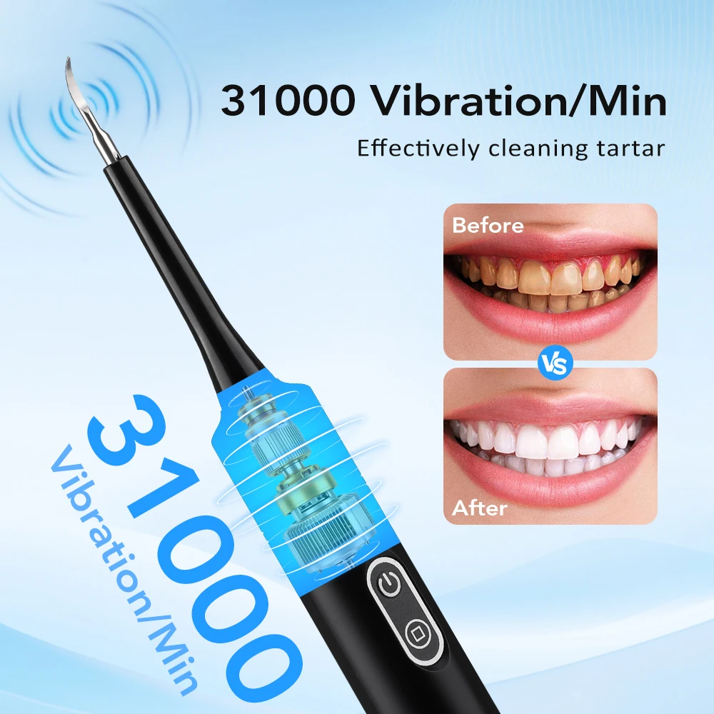 Escova de Dentes Elétrica com  - Teeth Whitening Uk avaliação e preço